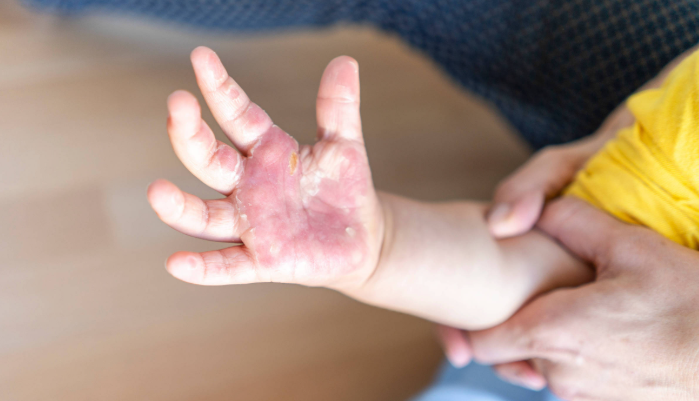 {5C73B37A-3012-4A95-9BFB-ABC1166D3606}