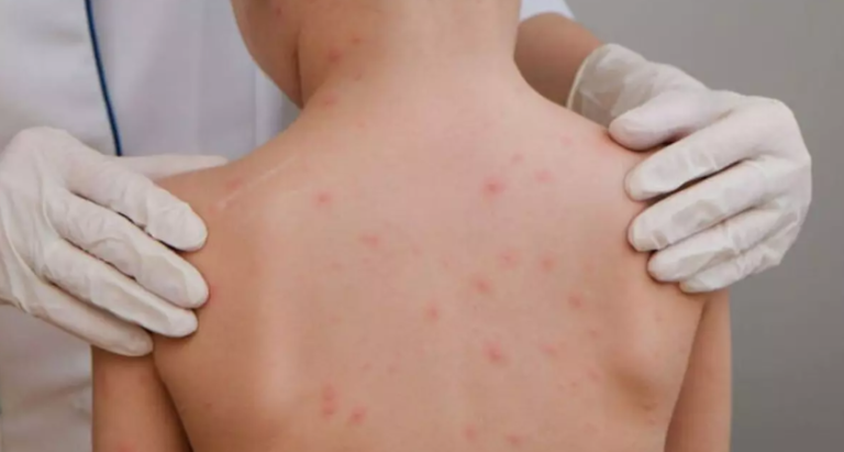 {979B12E4-F7D8-47B1-9714-A54E2F9C6AE7}